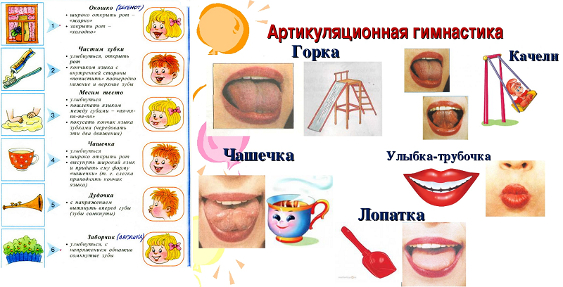 логопед в детском саду - ЦПМПК в Москве